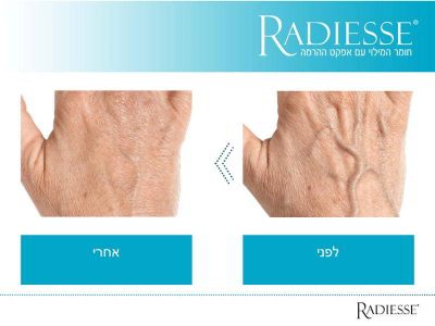 Radiess уникальный препарат в области косметологии
